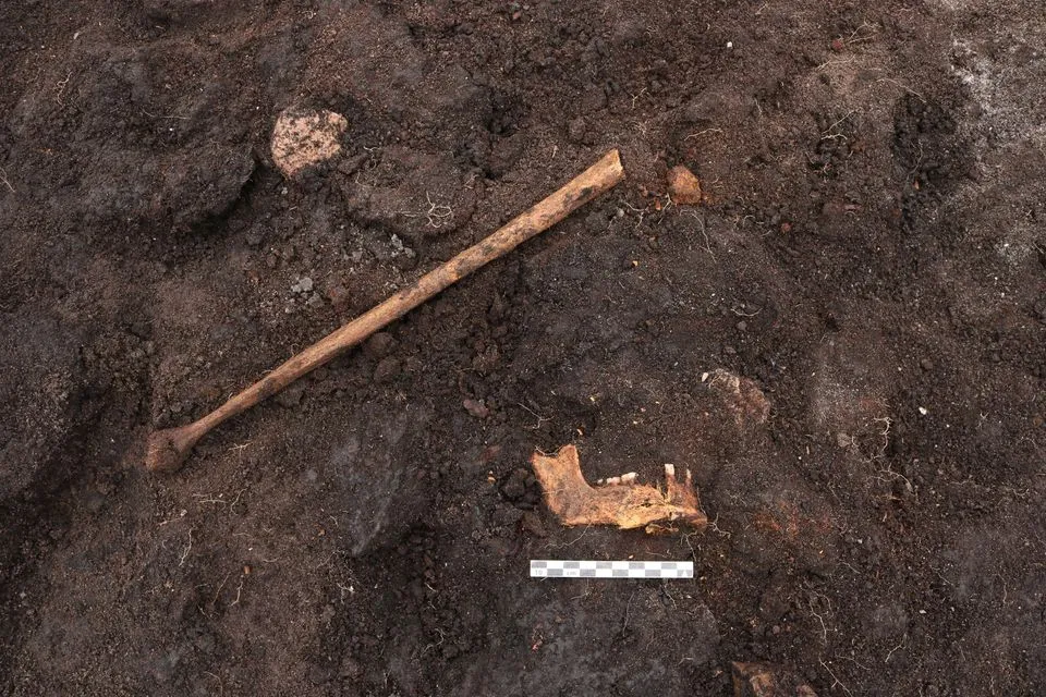 human bones